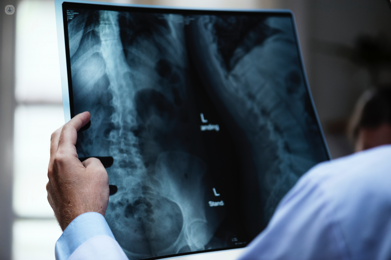 La radiografía permite detectar lesiones o anomalías en los huesos