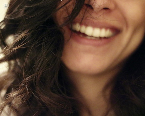 Foto ligeramente borrosa que muestra el rostro de una chica sonriendo - coronas y carillas by Top Doctors