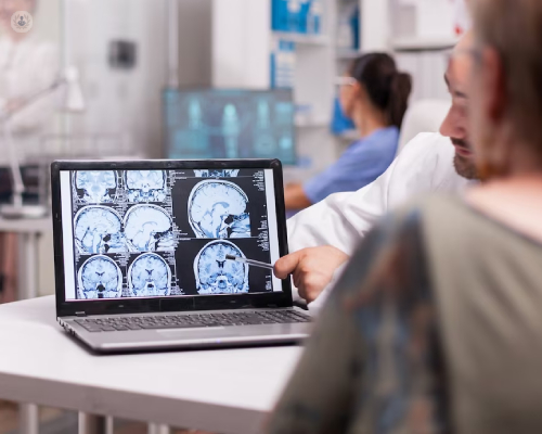 Doctor mostrando a una paciente una imagen de un cerebro en una pantalla - epilepsia | by Top Doctors