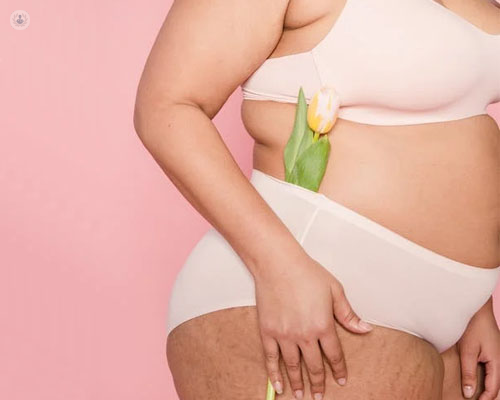 Primer plano mujer de perfil con celulitis - celuliltis vs sobrepeso - by Top Doctors