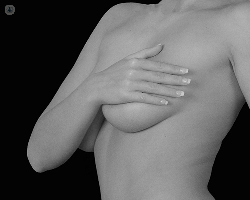 Chica tapándose el pecho - aumento mamario con técnica por la axila by Top Doctors