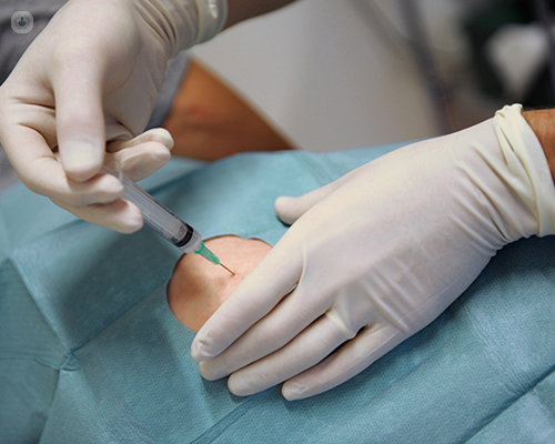 Médico pinchando una infiltración de ozono a un paciente -  by Top Doctors