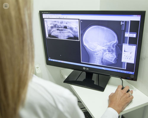 Doctora observando una radiografía creaneal y de mandíbula en la pantalla de un ordenador - latigazo cervical y problemas de ATM - by Top Doctors