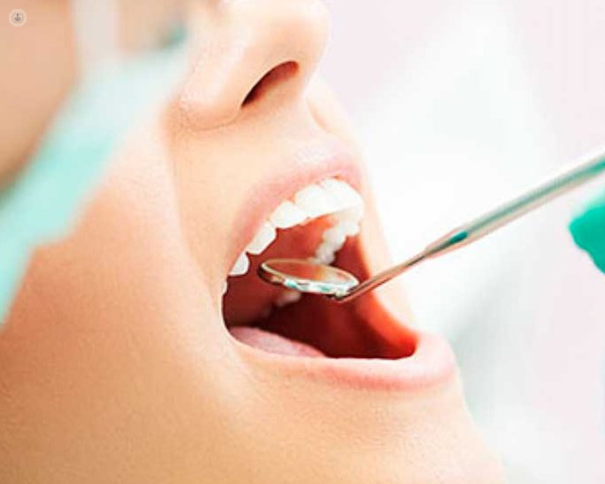 La caída de dientes dificulta el día a día del paciente - Top Doctors