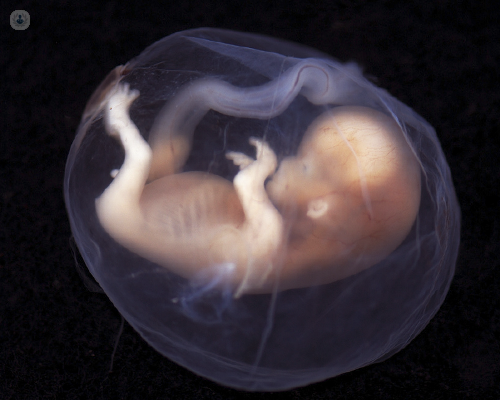 Imagen de un embrión - by Top Doctors