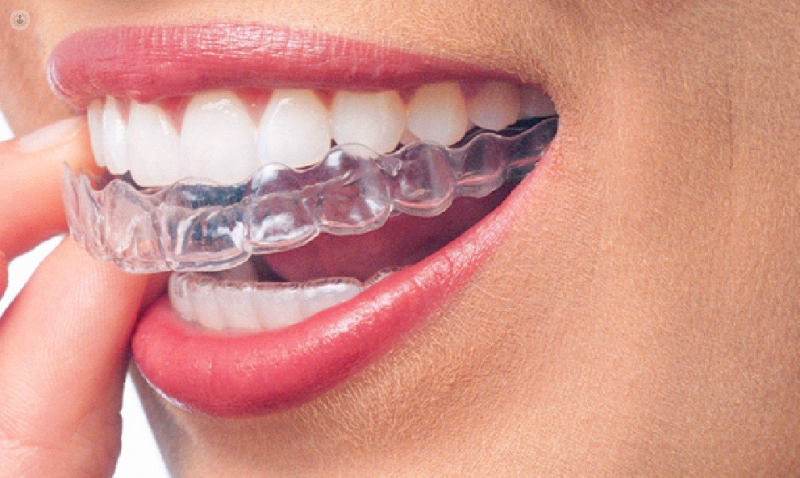 Invisalign ha supuesto una revolución en la ortodoncia