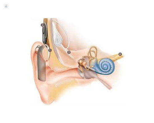 Partes del oído que intervienen en la recepción de la señal acústica - Top Doctors