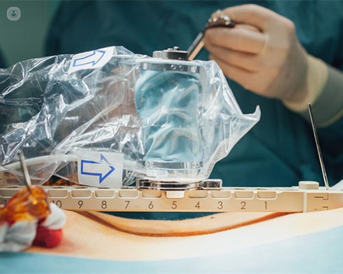 Robot quirúrgico reinassance | Top Doctors