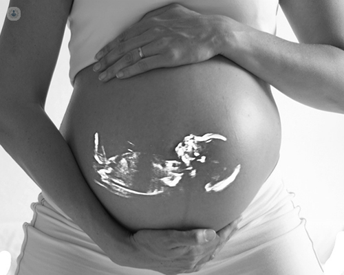 Mujer embarazada con imagen de ecografía en el vientre - by Top Doctors