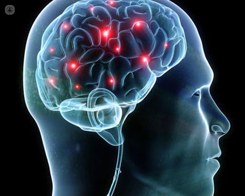 Infografía o dibujo que muestra un cerebro y sus conexiones - tumores cerebrales - by Top Doctors